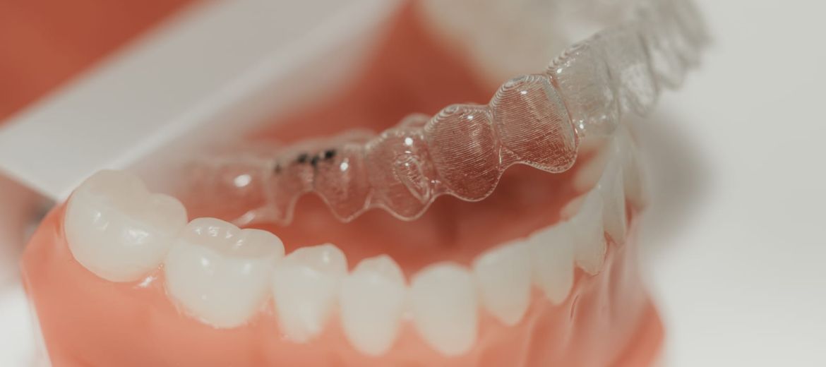 Invisalign & Clear Aligners