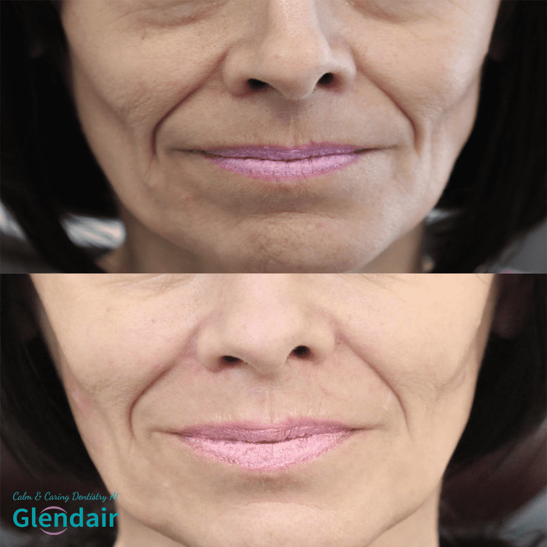 Glendair Dental Face And Beauty Treatments