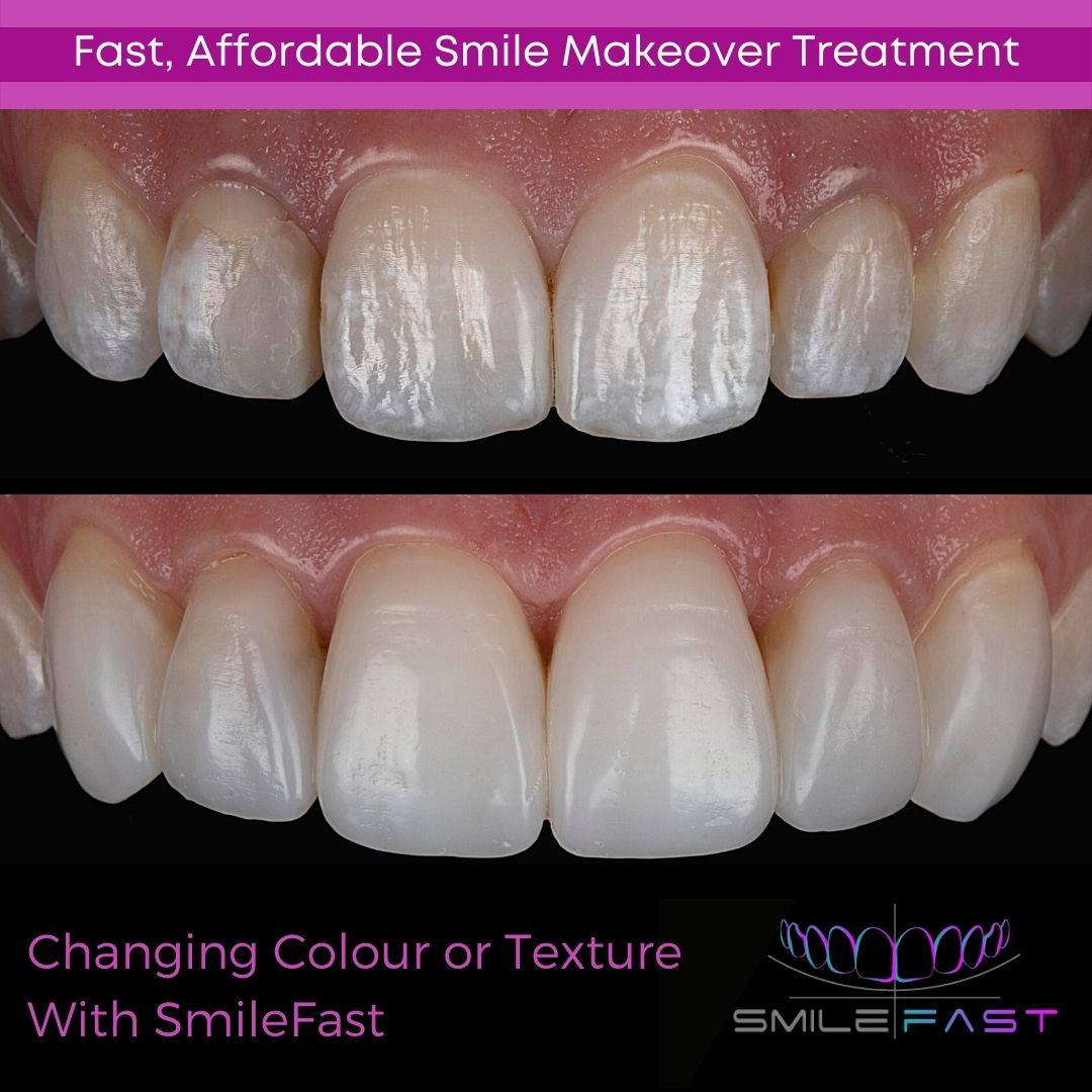 Glendair Dental SmileFast