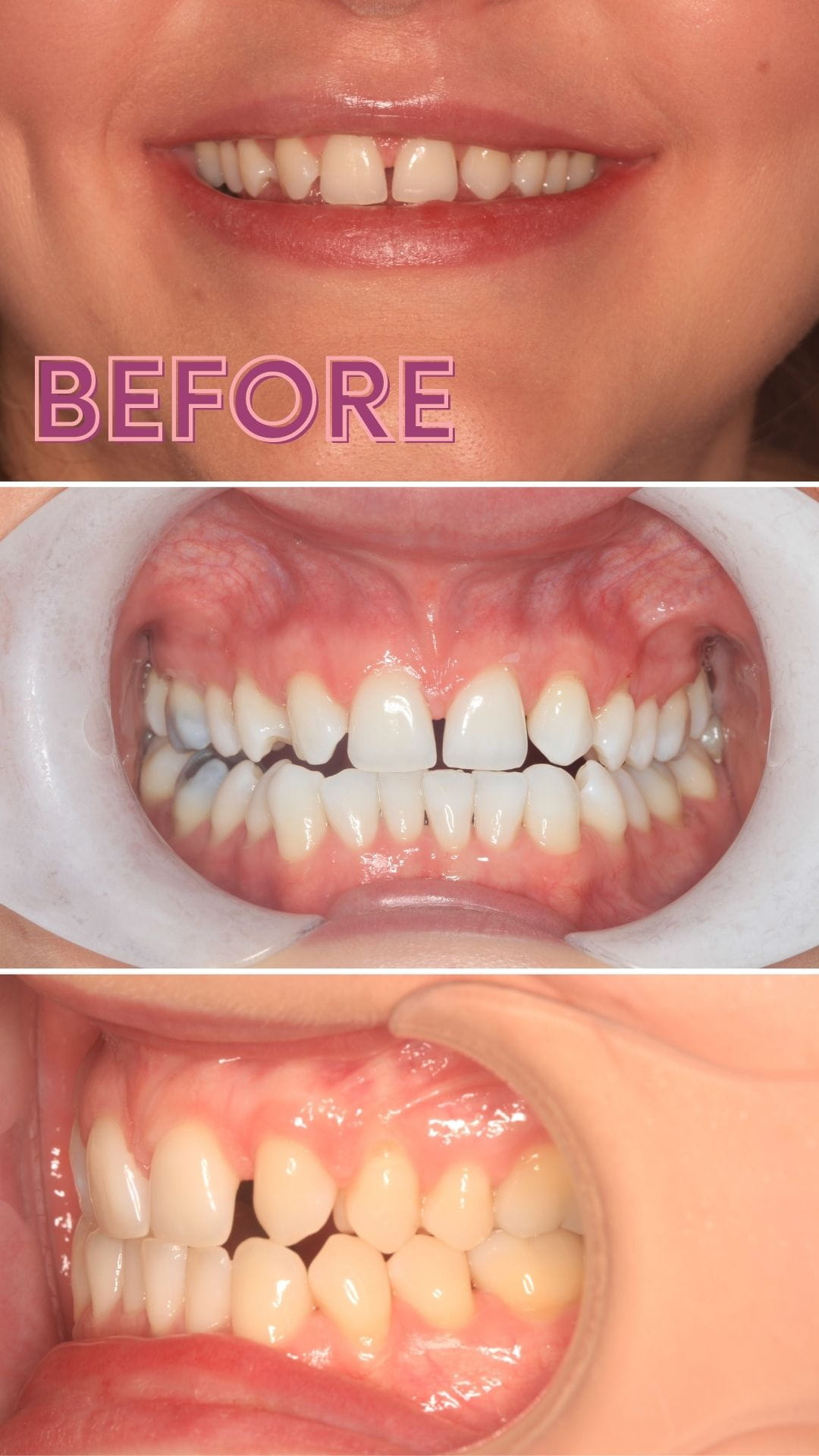 smile makeover treatment