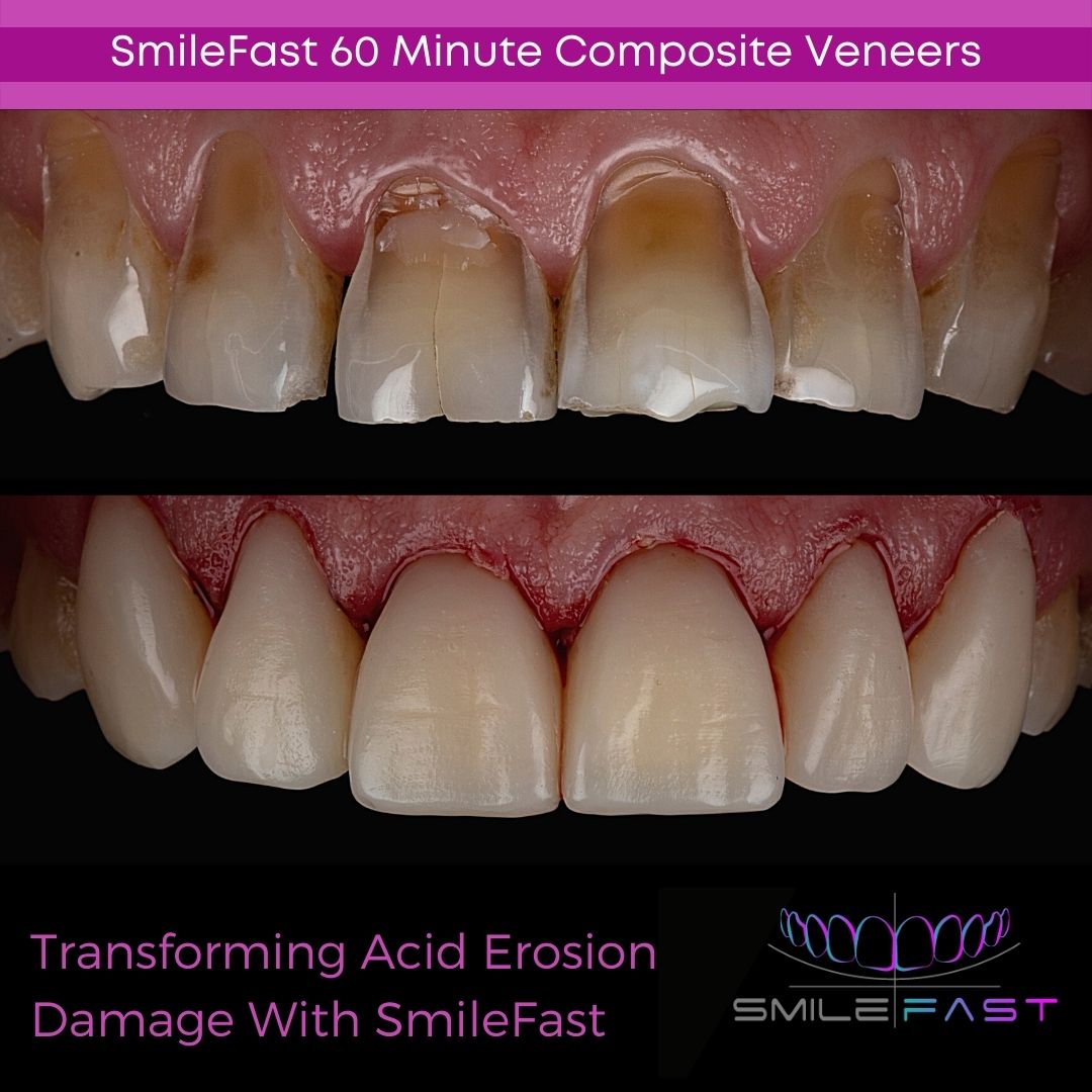 Glendair Dental SmileFast