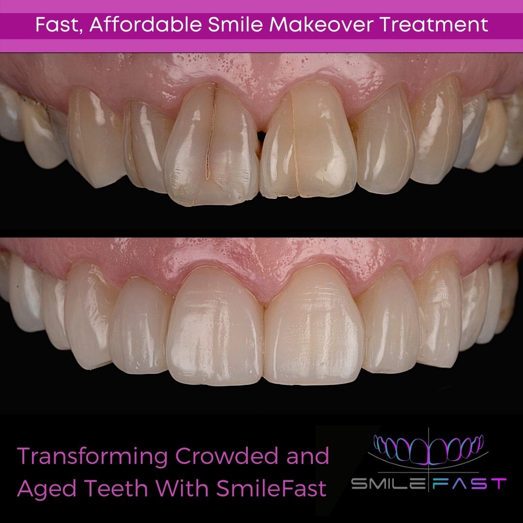 Glendair Dental SmileFast