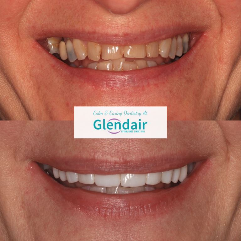 Glendair Dental Patient Success Stories Glendair Dental Patient Success Stories
