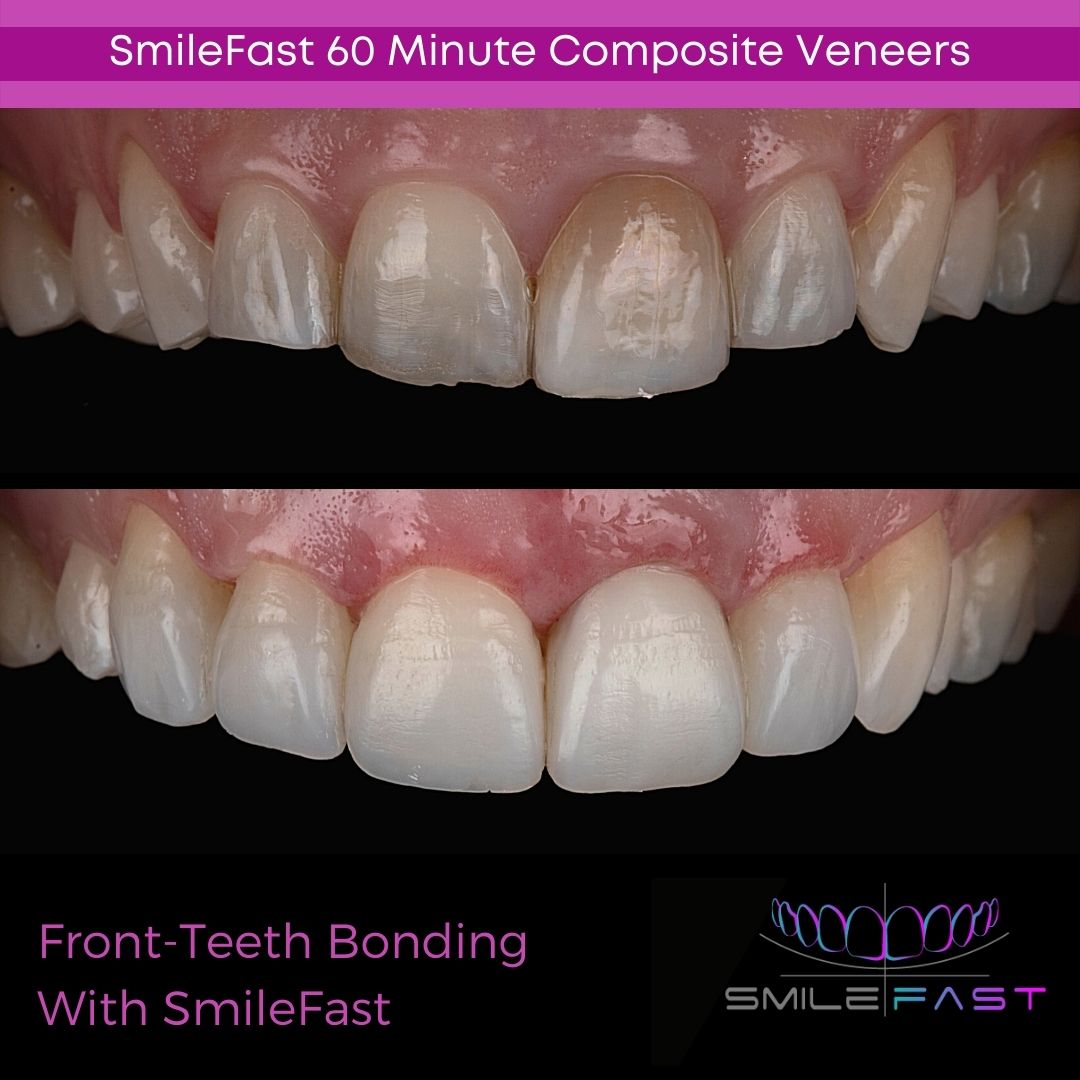 Glendair Dental SmileFast