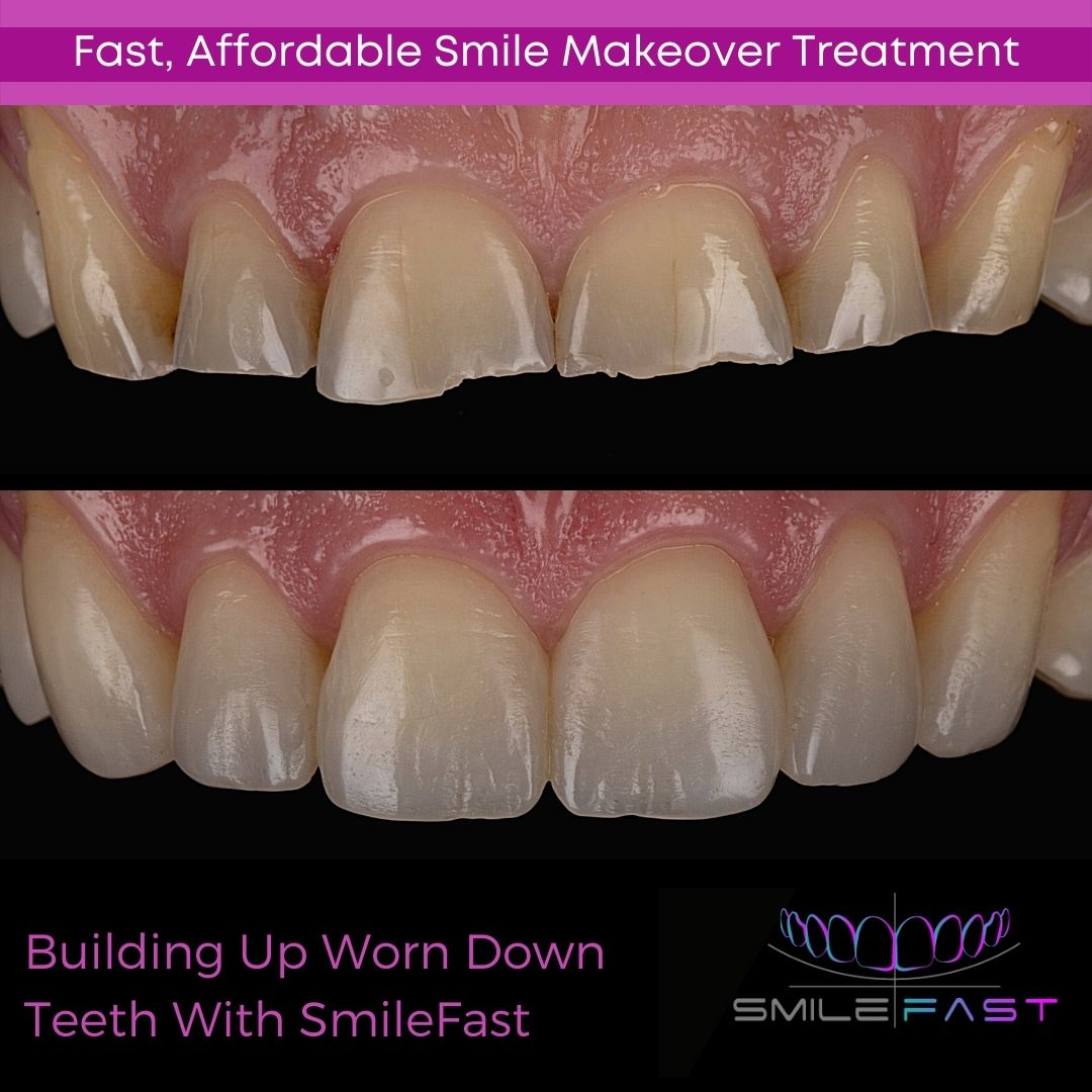 Glendair Dental SmileFast