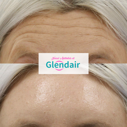 Glendair Dental Face And Beauty Treatments Glendair Dental Face And Beauty Treatments