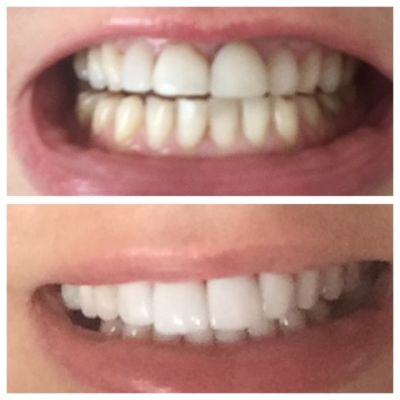 Glendair Dental Patient Success Stories Glendair Dental Patient Success Stories