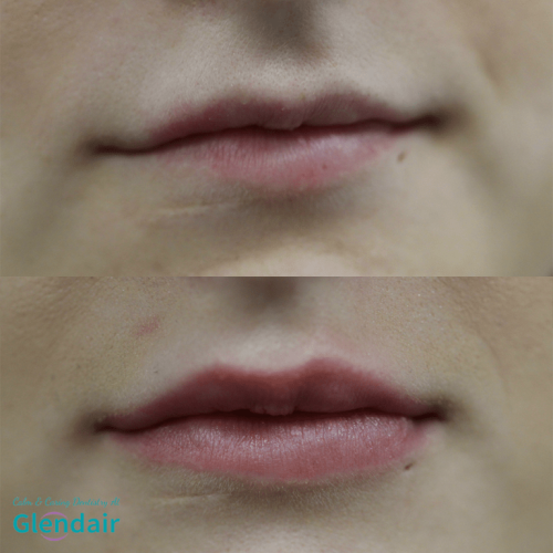 Glendair Dental Face And Beauty Treatments Glendair Dental Face And Beauty Treatments