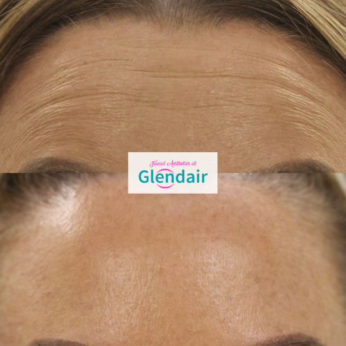 Glendair Dental Face And Beauty Treatments Glendair Dental Face And Beauty Treatments