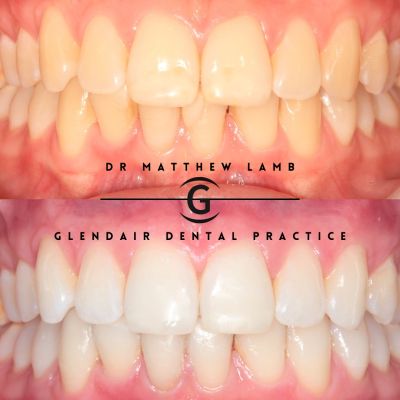 Glendair Dental New Patient Event Registration Page
