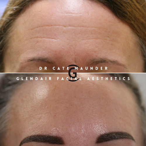 Glendair Dental Face And Beauty Treatments Glendair Dental Face And Beauty Treatments