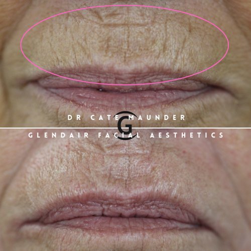 Glendair Dental Face And Beauty Treatments Glendair Dental Face And Beauty Treatments