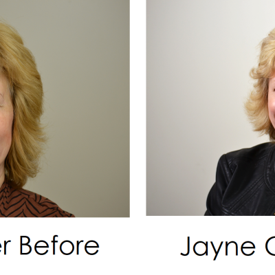 Glendair Dental Patient Success Stories Glendair Dental Patient Success Stories
