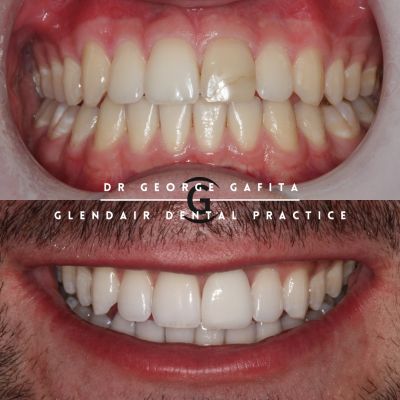 Glendair Dental New Patient Event Registration Page