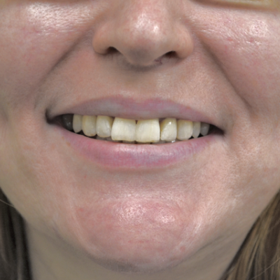 Glendair Dental Patient Success Stories Glendair Dental Patient Success Stories