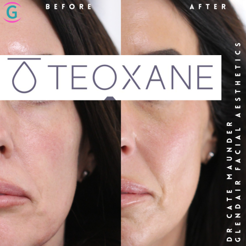 Glendair Dental Face And Beauty Treatments Before And After Beauty Treatment