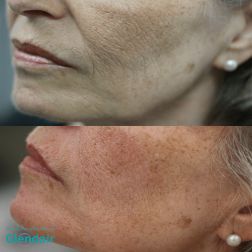 Glendair Dental Face And Beauty Treatments Glendair Dental Face And Beauty Treatments