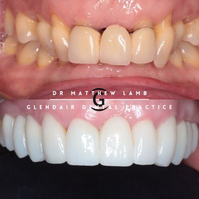 Glendair Dental New Patient Event Registration Page