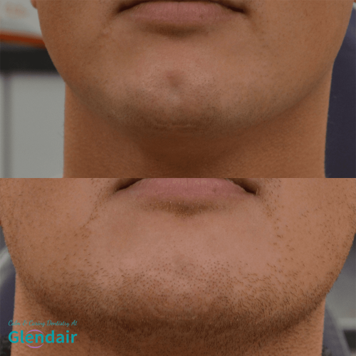 Glendair Dental Face And Beauty Treatments Glendair Dental Face And Beauty Treatments