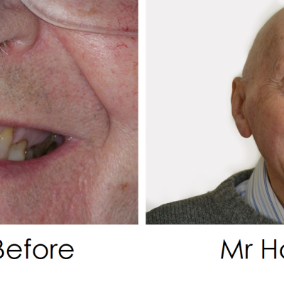Glendair Dental Patient Success Stories Glendair Dental Patient Success Stories
