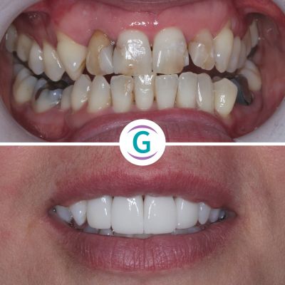 Glendair Dental New Patient Event Registration Page