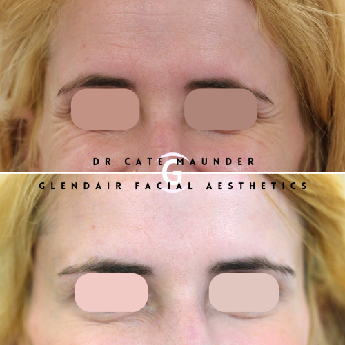 Glendair Dental Face And Beauty Treatments Glendair Dental Face And Beauty Treatments